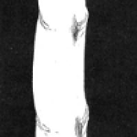 손2