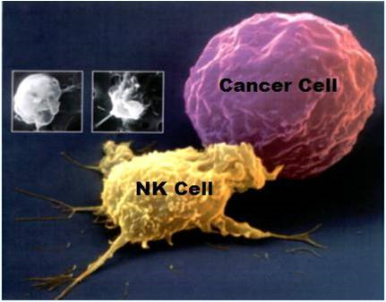암을 공격하는 NK cell.png