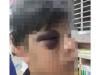 /files/thumbnails/624/572/632/100x75.crop.jpg?t=1747287031